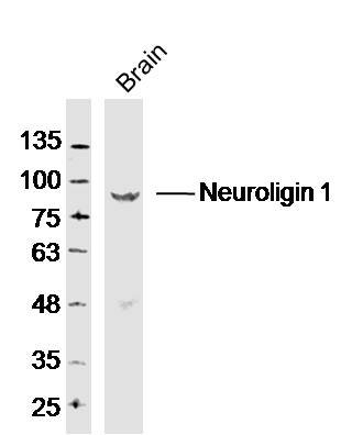 Mouse Cerebrum lysates probed with Neuroligin 1 Polyclonal Antibody, Unconjugated (bs-4212R) at 1:300 dilution and 4˚C overnight incubation. Followed by conjugated secondary antibody incubation at 1:20000 for 60 min at 37˚C.