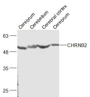 Lane 1: Mouse Cerebrum lysates; Lane 2: Mouse Cerebellum lysates; Lane 3: Mouse Cerebral cortex lysates; Lane 4: Rat Cerebrum lysates probed with CHRNB2 Polyclonal Antibody, Unconjugated (bs-4247R) at 1:500 dilution and 4˚C overnight incubation. Followed by conjugated secondary antibody incubation at 1:20000 for 60 min at 37˚C.