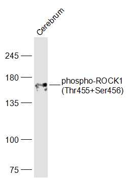 Mouse Cerebrum lysates probed with ROCK1(Thr455+Ser456) Polyclonal Antibody, Unconjugated (bs-4630R) at 1:1000 dilution and 4˚C overnight incubation. Followed by conjugated secondary antibody incubation at 1:20000 for 60 min at 37˚C.