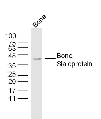 Mouse bone lysates probed with Bone Sialoprotein Polyclonal Antibody, Unconjugated (bs-4729R) at 1:300 dilution and 4˚C overnight incubation. Followed by conjugated secondary antibody incubation at 1:20000 for 60 min at 37˚C.