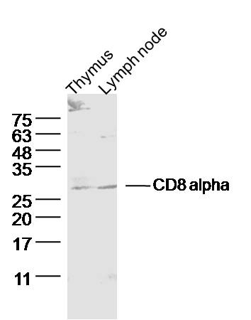 Lane 1: Rat Thymus lysates; Lane 2: Rat lymph node lysates probed with CD8 alpha Polyclonal Antibody, Unconjugated (bs-4791R) at 1:300 dilution and 4˚C overnight incubation. Followed by conjugated secondary antibody incubation at 1:20000 for 60 min at 37˚C.