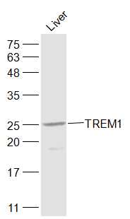 Rat Liver lysates probed with TREM1 Polyclonal Antibody, Unconjugated (bs-4886R) at 1:1000 dilution and 4˚C overnight incubation. Followed by conjugated secondary antibody incubation at 1:20000 for 60 min at 37˚C.
