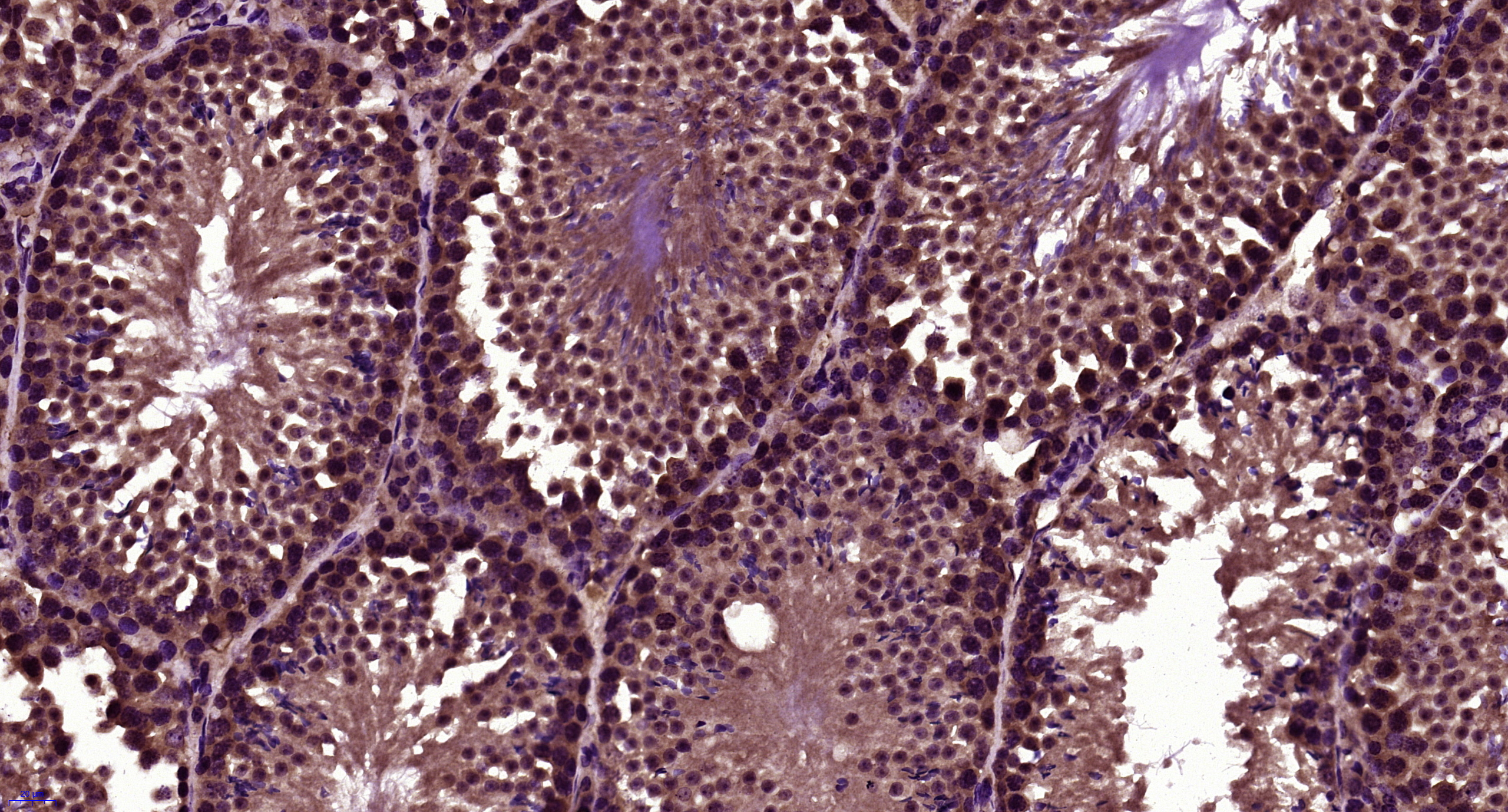 Paraformaldehyde-fixed, paraffin embedded Mouse testis; Antigen retrieval by boiling in sodium citrate buffer (pH6.0) for 15min; Block endogenous peroxidase by 3% hydrogen peroxide for 20 minutes; Blocking buffer (normal goat serum) at 37°C for 30min; Antibody incubation with LBX1 Polyclonal Antibody, Unconjugated (bs-11867R) at 1:400 overnight at 4°C, followed by secondary and DAB staining.