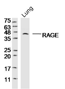 Mouse lung lysates probed with RAGE Polyclonal Antibody, Unconjugated (bs-4999R) at 1:300 dilution and 4˚C overnight incubation. Followed by conjugated secondary antibody incubation at 1:20000 for 60 min at 37˚C.