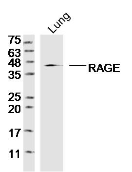 Rat lung lysates probed with RAGE Polyclonal Antibody, Unconjugated (bs-4999R) at 1:300 dilution and 4˚C overnight incubation. Followed by conjugated secondary antibody incubation at 1:20000 for 60 min at 37˚C.