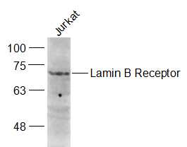 Jurkat cell lysates probed with Lamin B Receptor Polyclonal Antibody, Unconjugated (bs-5081R) at 1:1000 dilution and 4˚C overnight incubation. Followed by conjugated secondary antibody incubation at 1:20000 for 60 min at 37˚C.