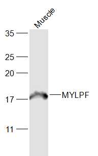 Mouse muscle lysates probed with MYLPF Polyclonal Antibody, Unconjugated (bs-5159R) at 1:1000 dilution and 4˚C overnight incubation. Followed by conjugated secondary antibody incubation at 1:20000 for 60 min at 37˚C.