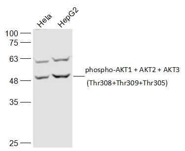 Lane 1: Hela cell lysates; Lane 2: HepG2 cell lysates probed with phospho-AKT1 + AKT2 + AKT3 (Thr308+Thr309+Thr305) Polyclonal Antibody, Unconjugated (bs-5182R) at 1:300 dilution and 4˚C overnight incubation. Followed by conjugated secondary antibody incubation at 1:20000 for 60 min at 37˚C. The upper band could be the fully glycosylated form of the target protein.
