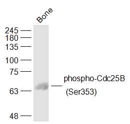 Mouse bone lysates probed with Cdc25B (Ser353) Polyclonal Antibody, Unconjugated (bs-5245R) at 1:1000 dilution and 4˚C overnight incubation. Followed by conjugated secondary antibody incubation at 1:20000 for 60 min at 37˚C. Mouse bone lysates probed with Cdc25B (Ser353) Polyclonal Antibody, Unconjugated (bs-5245R) at 1:1000 dilution and 4˚C overnight incubation. Followed by conjugated secondary antibody incubation at 1:20000 for 60 min at 37˚C.