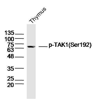 Rat thymus lysates probed with TAK1(Ser192) Polyclonal Antibody, Unconjugated (bs-5405R) at 1:300 dilution and 4˚C overnight incubation. Followed by conjugated secondary antibody incubation at 1:20000 for 60 min at 37˚C.