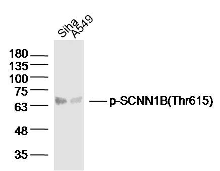 Lane 1: Siha cell lysates; Lane 2: A549 cell lysates probed with SCNN1B(Thr615) Polyclonal Antibody, Unconjugated (bs-5701R) at 1:300 dilution and 4°C overnight incubation. Followed by conjugated secondary antibody incubation at 1:20000 for 60 min at 37°C.