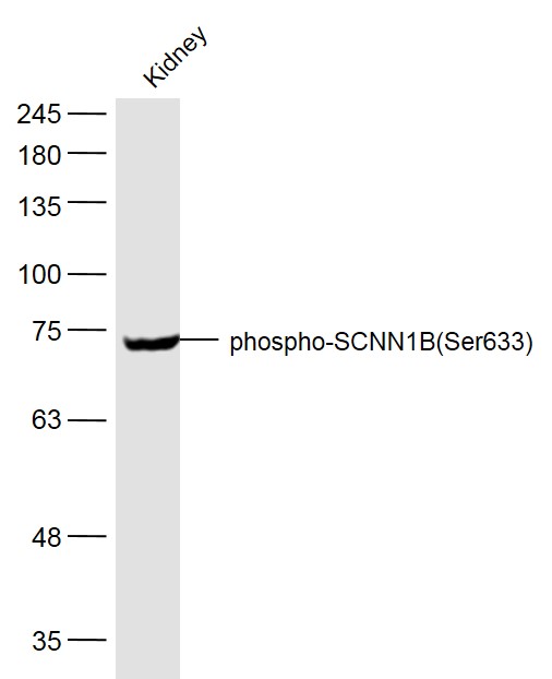 Mouse kidney lysates probed with SCNN1B(Ser633) Polyclonal Antibody, Unconjugated (bs-5702R) at 1:500 dilution and 4˚C overnight incubation. Followed by conjugated secondary antibody incubation at 1:20000 for 60 min at 37˚C.