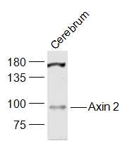 Mouse Cerebrum lysates probed with Axin 2 Polyclonal Antibody, Unconjugated (bs-5717R) at 1:1000 dilution and 4˚C overnight incubation. Followed by conjugated secondary antibody incubation at 1:20000 for 60 min at 37˚C.