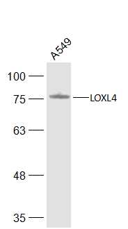 A549 cell lysates probed with LOXL4 Polyclonal Antibody, Unconjugated (bs-5790R) at 1:500 dilution and 4˚C overnight incubation. Followed by conjugated secondary antibody incubation at 1:20000 for 60 min at 37˚C. A549 cell lysates probed with LOXL4 Polyclonal Antibody, Unconjugated (bs-5790R) at 1:500 dilution and 4˚C overnight incubation. Followed by conjugated secondary antibody incubation at 1:20000 for 60 min at 37˚C.