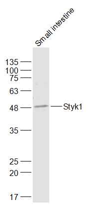 Mouse small intestine lysates probed with Styk1 Polyclonal Antibody, Unconjugated (bs-5957R) at 1:300 dilution and 4˚C overnight incubation. Followed by conjugated secondary antibody incubation at 1:20000 for 60 min at 37˚C.