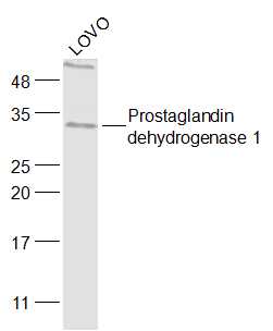Lovo cell lysates probed with Prostaglandin dehydrogenase 1 Polyclonal Antibody, Unconjugated (bs-6051R) at 1:1000 dilution and 4˚C overnight incubation. Followed by conjugated secondary antibody incubation at 1:20000 for 60 min at 37˚C.