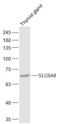 Rat thyroid lysates probed with SLC5A8 Polyclonal Antibody, Unconjugated (bs-6106R) at 1:1000 dilution and 4˚C overnight incubation. Followed by conjugated secondary antibody incubation at 1:20000 for 60 min at 37˚C.
