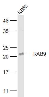 K562 cell lysates probed with RAB9 Polyclonal Antibody, Unconjugated (bs-6177R) at 1:1000 dilution and 4˚C overnight incubation. Followed by conjugated secondary antibody incubation at 1:20000 for 60 min at 37˚C.