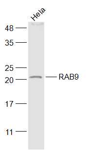 Hela cell lysates probed with RAB9 Polyclonal Antibody, Unconjugated (bs-6177R) at 1:1000 dilution and 4˚C overnight incubation. Followed by conjugated secondary antibody incubation at 1:20000 for 60 min at 37˚C.
