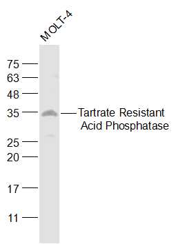 Molt-4 cell lysates probed with Tartrate Resistant Acid Phosphatase Polyclonal Antibody, Unconjugated (bs-6434R) at 1:1000 dilution and 4˚C overnight incubation. Followed by conjugated secondary antibody incubation at 1:20000 for 60 min at 37˚C.