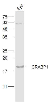 Mouse eye lysates probed with CRABP1/Retinol binding protein Polyclonal Antibody, Unconjugated (bs-6442R) at 1:1000 dilution and 4˚C overnight incubation. Followed by conjugated secondary antibody incubation at 1:20000 for 60 min at 37˚C.