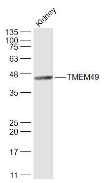 Mouse kidney lysates probed with TMEM49 Polyclonal Antibody, Unconjugated (bs-6740R) at 1:1000 dilution and 4˚C overnight incubation. Followed by conjugated secondary antibody incubation at 1:20000 for 60 min at 37˚C.