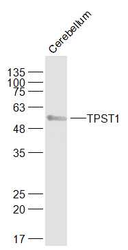 Mouse cerebellum lysates probed with TPST1 Polyclonal Antibody, Unconjugated (bs-6850R) at 1:1000 dilution and 4˚C overnight incubation. Followed by conjugated secondary antibody incubation at 1:20000 for 60 min at 37˚C.
