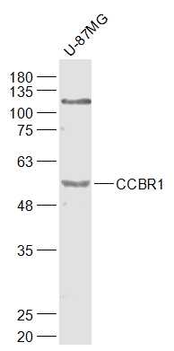 U87MG cell lysates probed with CCBR1 Polyclonal Antibody, Unconjugated (bs-6883R) at 1:1000 dilution and 4˚C overnight incubation. Followed by conjugated secondary antibody incubation at 1:20000 for 60 min at 37˚C.