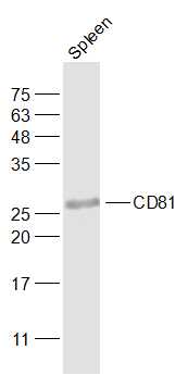 Mouse spleen lysates probed with CD81 Polyclonal Antibody, Unconjugated (bs-6934R) at 1:1000 dilution and 4˚C overnight incubation. Followed by conjugated secondary antibody incubation at 1:20000 for 60 min at 37˚C.