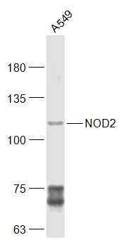 A549 cell lysates probed with CARD15/NOD2 Polyclonal Antibody, Unconjugated (bs-7084R) at 1:300 dilution and 4˚C overnight incubation. Followed by conjugated secondary antibody incubation at 1:20000 for 60 min at 37˚C.