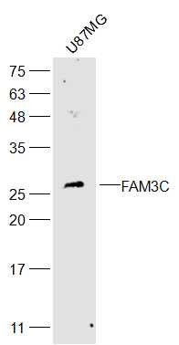 U87MG cell lysates probed with FAM3C Polyclonal Antibody, Unconjugated (bs-7862R) at 1:2000 dilution and 4˚C overnight incubation. Followed by conjugated secondary antibody incubation at 1:20000 for 60 min at 37˚C. U87MG cell lysates probed with FAM3C Polyclonal Antibody, Unconjugated (bs-7862R) at 1:2000 dilution and 4˚C overnight incubation. Followed by conjugated secondary antibody incubation at 1:20000 for 60 min at 37˚C.