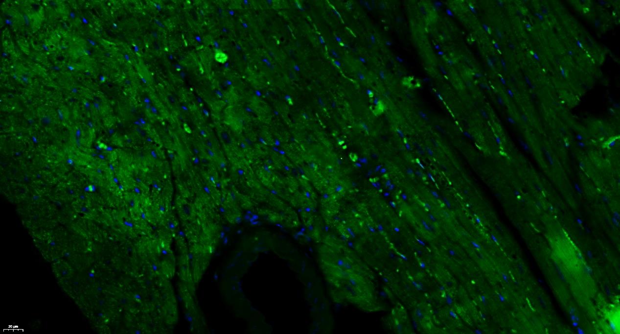 Paraformaldehyde-fixed, paraffin embedded Mouse heart; Antigen retrieval by boiling in sodium citrate buffer (pH6.0) for 15min; Blocking buffer (normal goat serum) at 37°C for 30min; Antibody incubation with GPR126 Polyclonal Antibody, Unconjugated (bs-12027R) at 1:400 overnight at 4°C, followed by a conjugated Goat Anti-Rabbit IgG antibody (bs-0295G-FITC) for 90 minutes, and DAPI for nuclei staining.