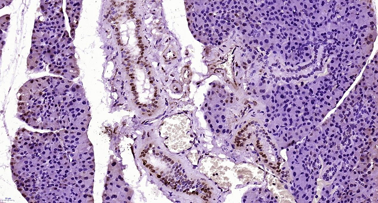 Paraformaldehyde-fixed, paraffin embedded Mouse lymph node; Antigen retrieval by boiling in sodium citrate buffer (pH6.0) for 15min; Block endogenous peroxidase by 3% hydrogen peroxide for 20 minutes; Blocking buffer (normal goat serum) at 37°C for 30min; Antibody incubation with Chondroitin Sulfate Polyclonal Antibody, Unconjugated (bs-5178R) at 1:400 overnight at 4°C, followed by secondary and DAB staining.