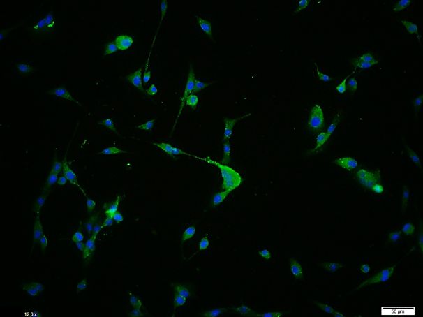 Tissue/cell: U-87MG cell; 4% Paraformaldehyde-fixed; Triton X-100 at room temperature for 20 min; Blocking buffer (normal goat serum) at 37°C for 20 min; Antibody incubation with G1switch 2 Polyclonal Antibody, Unconjugated (bs-8656R) at 1:100, 90 minutes at 37°C; followed by a conjugated Goat Anti-Rabbit IgG antibody (bs-0295G-FITC) at 37°C for 90 minutes, DAPI (5ug/ml, blue) was used to stain the cell nuclei.