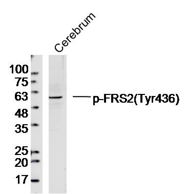 Mouse Cerebrum lysates probed with FRS2(Tyr436) Polyclonal Antibody, Unconjugated (bs-7902R) at 1:300 dilution and 4˚C overnight incubation. Followed by conjugated secondary antibody incubation at 1:20000 for 60 min at 37˚C.