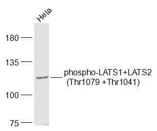 Hela cell lysates probed with LATS1+LATS2 (Thr1079 +Thr1041) Polyclonal Antibody, Unconjugated (bs-7913R) at 1:1000 dilution and 4°C overnight incubation. Followed by conjugated secondary antibody incubation at 1:20000 for 60 min at 37°C.