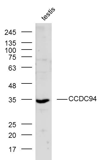Mouse testis lysates probed with CCDC94 Polyclonal Antibody, Unconjugated (bs-8081R) at 1:300 dilution and 4˚C overnight incubation. Followed by conjugated secondary antibody incubation at 1:20000 for 60 min at 37˚C.