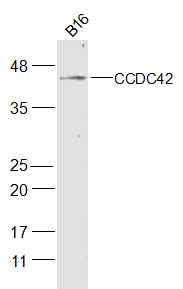 B16 cell lysates probed with CCDC42 Polyclonal Antibody, Unconjugated (bs-8131R) at 1:300 dilution and 4˚C overnight incubation. Followed by conjugated secondary antibody incubation at 1:20000 for 60 min at 37˚C.