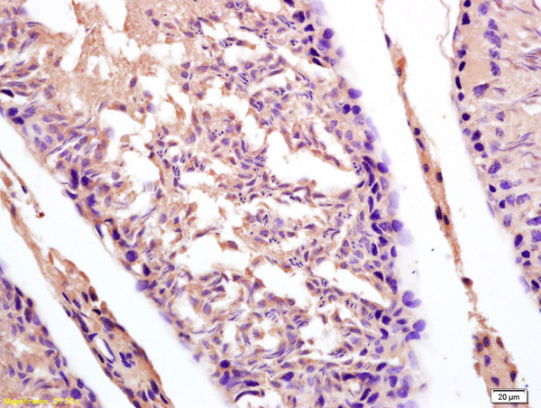 Formalin-fixed and paraffin embedded rat testis labeled with Anti-DDX43/CT13 Polyclonal Antibody, Unconjugated (bs-6226R) at 1:200 followed by conjugation to the secondary antibody and DAB staining.