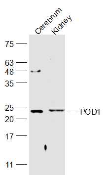 Lane 1: Mouse Cerebrum lysates; Lane 2: Rat kidney lysates probed with POD1 Polyclonal Antibody, Unconjugated (bs-8688R) at 1:1000 dilution and 4˚C overnight incubation. Followed by conjugated secondary antibody incubation at 1:20000 for 60 min at 37˚C.