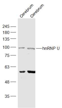 Lane 1:Mouse cerebrum lysates; Lane 2: Rat cerebrum lysates probed with hnRNP U Polyclonal Antibody, Unconjugated (bs-9092R) at 1:1000 dilution and 4˚C overnight incubation. Followed by conjugated secondary antibody incubation at 1:20000 for 60 min at 37˚C.