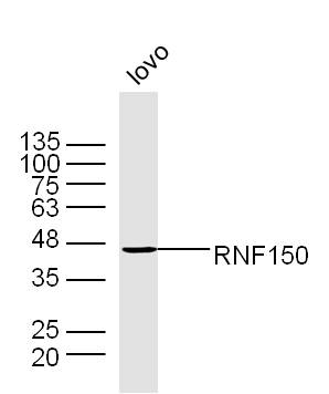 Lovo cell lysates probed with RNF150 Polyclonal Antibody, Unconjugated (bs-9257R) at 1:300 dilution and 4˚C overnight incubation. Followed by conjugated secondary antibody incubation at 1:20000 for 60 min at 37˚C.