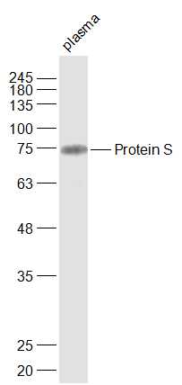 Mouse plasma lysates probed with Protein S Polyclonal Antibody, Unconjugated (bs-9512R) at 1:1000 dilution and 4˚C overnight incubation. Followed by conjugated secondary antibody incubation at 1:20000 for 60 min at 37˚C.