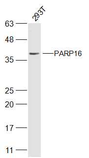 293T cell lysates probed with PARP16 Polyclonal Antibody, Unconjugated (bs-9623R) at 1:500 dilution and 4˚C overnight incubation. Followed by conjugated secondary antibody incubation at 1:20000 for 60 min at 37˚C.