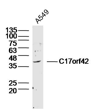 A549 cell lysates probed with C17orf42 Polyclonal Antibody, Unconjugated (bs-9639R) at 1:300 dilution and 4˚C overnight incubation. Followed by conjugated secondary antibody incubation at 1:20000 for 60 min at 37˚C.