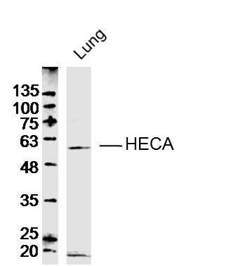 Rat lung lysates probed with HECA Polyclonal Antibody, Unconjugated (bs-9702R) at 1:300 dilution and 4˚C overnight incubation. Followed by conjugated secondary antibody incubation at 1:20000 for 60 min at 37˚C.