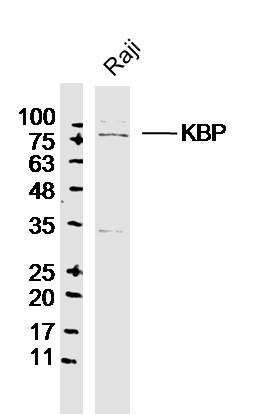Raji cell lysates probed with KBP Polyclonal Antibody, Unconjugated (bs-9716R) at 1:300 dilution and 4˚C overnight incubation. Followed by conjugated secondary antibody incubation at 1:20000 for 60 min at 37˚C.