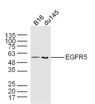 Lane 1: B16 cell lysates; Lane 2: DU145 cell lysates probed with EGFR5 Polyclonal Antibody, Unconjugated (bs-9813R) at 1:300 dilution and 4˚C overnight incubation. Followed by conjugated secondary antibody incubation at 1:20000 for 60 min at 37˚C.