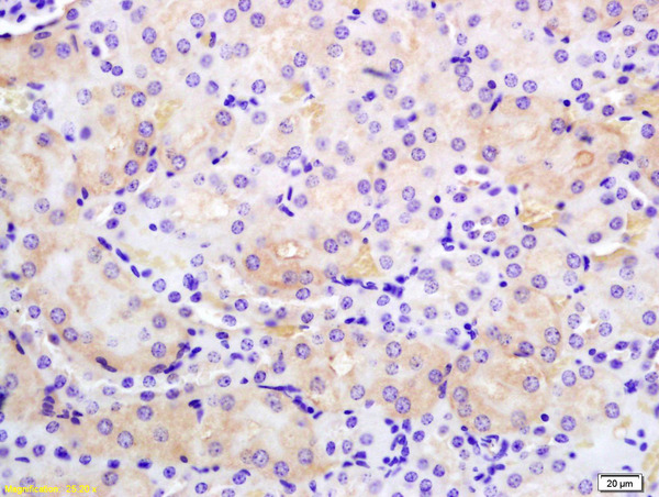 Formalin-fixed and paraffin embedded rat kidney labeled with Anti-PMCA Polyclonal Antibody, Unconjugated (bs-6499R) at 1:200 followed by conjugation to the secondary antibody and DAB staining.