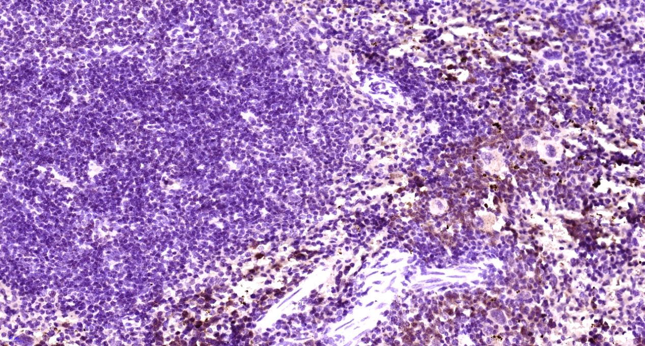 Paraformaldehyde-fixed, paraffin embedded Mouse spleen; Antigen retrieval by boiling in sodium citrate buffer (pH6.0) for 15min; Block endogenous peroxidase by 3% hydrogen peroxide for 20 minutes; Blocking buffer (normal goat serum) at 37°C for 30min; Antibody incubation with CLEC9A Polyclonal Antibody, Unconjugated (bs-13621R) at 1:400 overnight at 4°C, followed by secondary and DAB staining. Paraformaldehyde-fixed, paraffin embedded Mouse spleen; Antigen retrieval by boiling in sodium citrate buffer (pH6.0) for 15min; Block endogenous peroxidase by 3% hydrogen peroxide for 20 minutes; Blocking buffer (normal goat serum) at 37°C for 30min; Antibody incubation with CLEC9A Polyclonal Antibody, Unconjugated (bs-13621R) at 1:400 overnight at 4°C, followed by secondary and DAB staining.